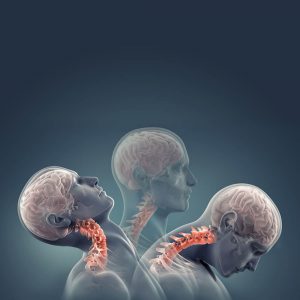 ant_Il_colpo_di_frusta