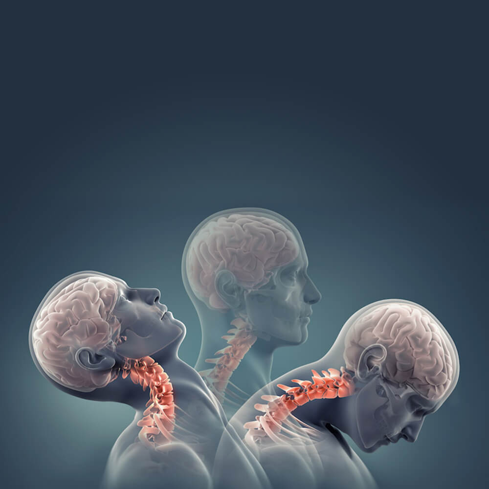 ant_Il_colpo_di_frusta