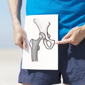 ant_cos’è il conflitto femoro-acetabolare